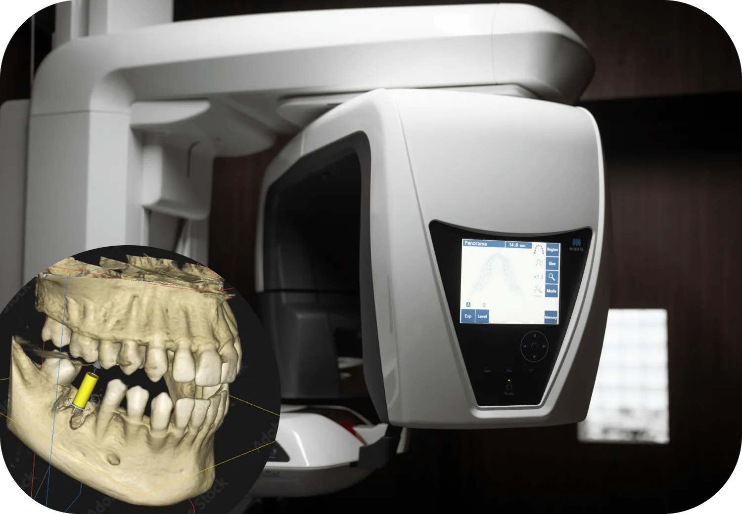 より正確な診断のために