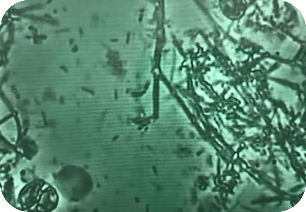 歯周病は、細菌による感染症です