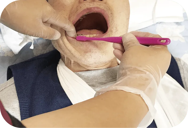 プロによる口腔清掃